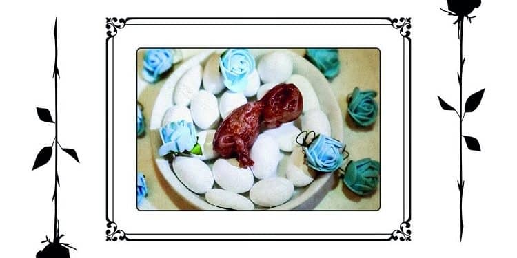 SCHELETRO: annunciano il nuovo album “Un feto schiacciato senza tre falangi”