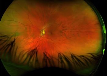 GREG PUCIATO – Mirrorcell