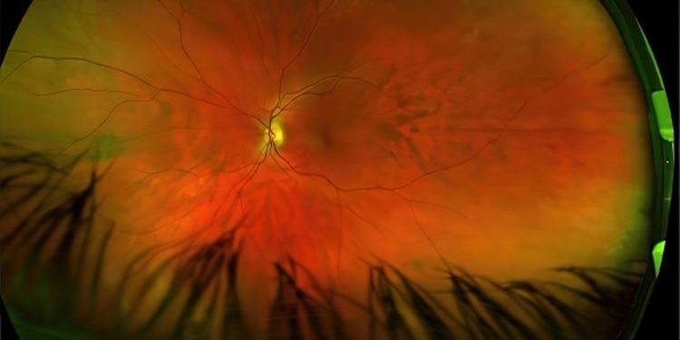 GREG PUCIATO – Mirrorcell